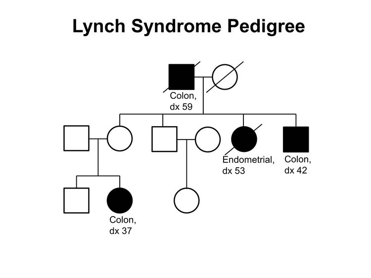 Pedigree showing some of the classic features of a family with Lynch syndrome across three generations, including transmission occurring through maternal and paternal lineages and the presence of both colon and endometrial cancers. Pedigree showing some of the classic features of a family with Lynch syndrome across three generations, including transmission occurring through maternal and paternal lineages and the presence of both colon and endometrial cancers.