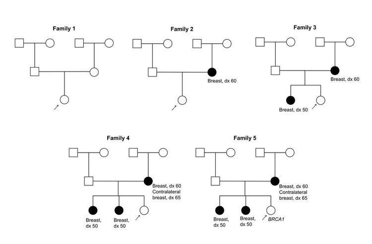 Five pedigrees are shown depicting probands with varying degrees of family history of breast cancer ranging from no affected first-degree relatives and no known BRCA mutation in the family (family 1) to three affected first-degree relatives, including one relative with bilateral breast cancer, and a known BRCA1 mutation in the family (family 5). Five pedigrees are shown depicting probands with varying degrees of family history of breast cancer ranging from no affected first-degree relatives and no known BRCA mutation in the family (family 1) to three affected first-degree relatives, including one relative with bilateral breast cancer, and a known BRCA1 mutation in the family (family 5).