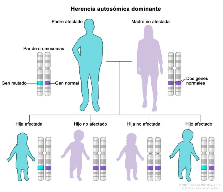 En la imagen se observa la distribución del tipo de herencia autosómica dominante en una familia conformada por padre, madre y cuatro hijos: se muestran un par de cromosomas con un gen mutado y un gen normal en el padre afectado; dos genes normales en la madre no afectada; un gen mutado y un gen normal en una hija afectada y en un hijo afectado; y dos genes normales en una hija no afectada y en un hijo no afectado. En la imagen se observa la distribución del tipo de herencia autosómica dominante en una familia conformada por padre, madre y cuatro hijos: se muestran un par de cromosomas con un gen mutado y un gen normal en el padre afectado; dos genes normales en la madre no afectada; un gen mutado y un gen normal en una hija afectada y en un hijo afectado; y dos genes normales en una hija no afectada y en un hijo no afectado.