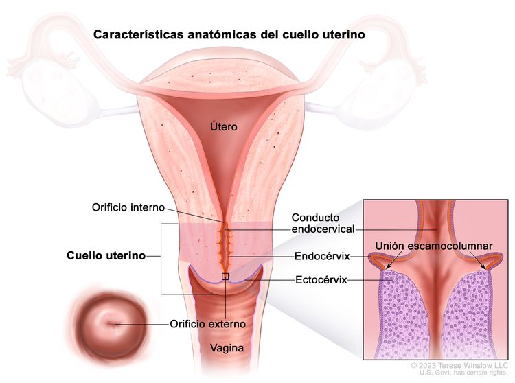 En el dibujo se observan las aracterísticas anatómicas del cuello uterino. Se muestran el orificio interno, el conducto endocervical, el endocérvix, el ectocérvix y el orificio externo. También se observan el útero y la vagina. Además, en un recuadro se muestra una vista de cerca de la unión escamocolumnar (área donde el endocérvix se une al ectocérvix) y las células que revisten el endocérvix y el ectocérvix. En el dibujo se observan las aracterísticas anatómicas del cuello uterino. Se muestran el orificio interno, el conducto endocervical, el endocérvix, el ectocérvix y el orificio externo. También se observan el útero y la vagina. Además, en un recuadro se muestra una vista de cerca de la unión escamocolumnar (área donde el endocérvix se une al ectocérvix) y las células que revisten el endocérvix y el ectocérvix.